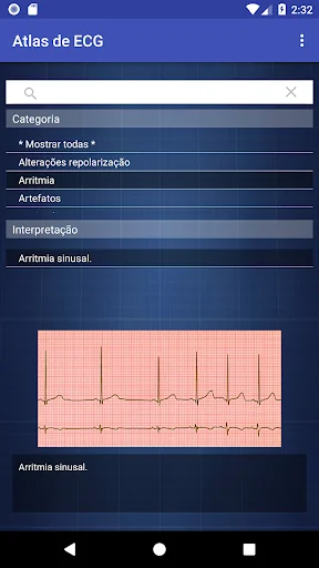 Atlas de ECG