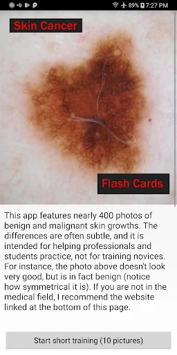 Skin Cancer Flashcard "game"