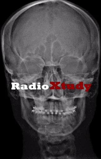 RadioXtudy