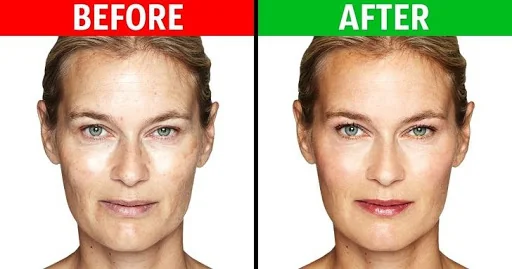 Wrinkles Removal Exercises