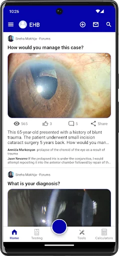 Eye Handbook