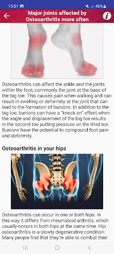 Joint Pain Osteoarthritis Help screenshot 3
