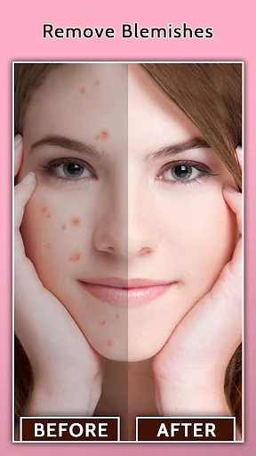 Face Blemish Remover - Smooth  screenshot 1
