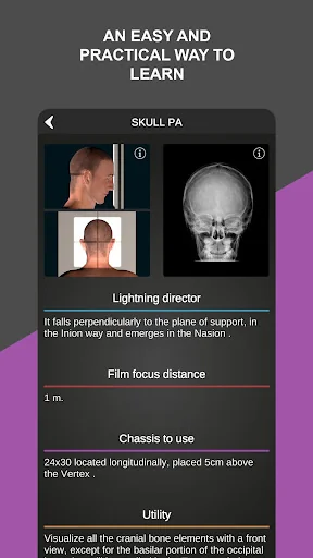 RX - Radiographic Positioning screenshot 3