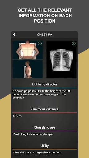 RX - Radiographic Positioning screenshot 4