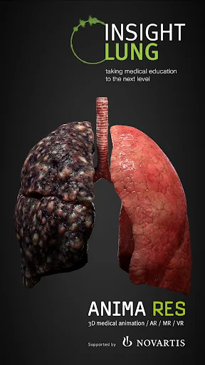 INSIGHT LUNG