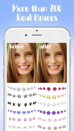 Braces