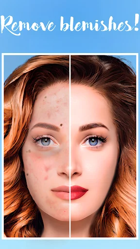 Blemish Remover - Face Editor