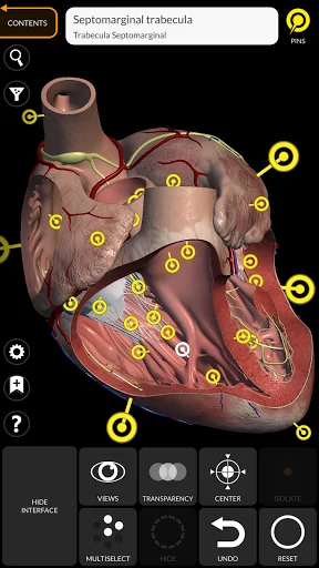 Anatomy 3D Atlas screenshot 3