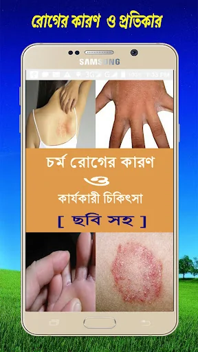 চর্ম রোগের কারণ  ও  চিকিৎসা