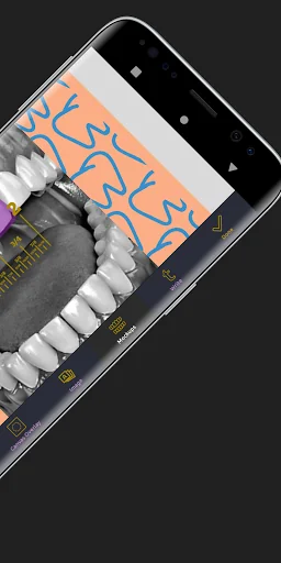 Dental Designer Pro screenshot 4