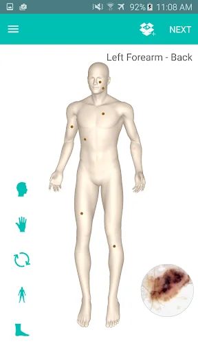 DermEngine