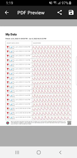 Pulse Oximeter - Beat & Oxygen screenshot 4