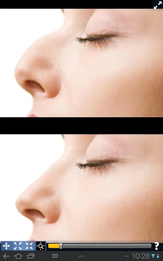 Plastic Surgery Simulator