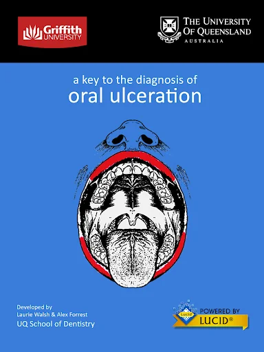 Diagnosis of Oral Ulceration