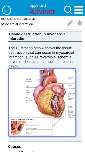 Lippincott Nursing Advisor screenshot 2