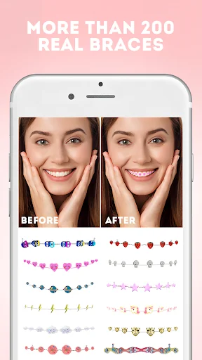 Braces Photo Editor screenshot 1
