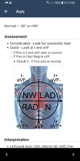 ECG Guide by QxMD screenshot 3