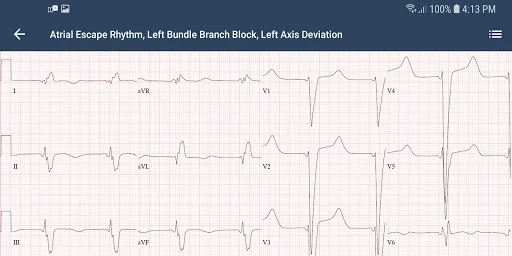 ECG Guide by QxMD screenshot 4