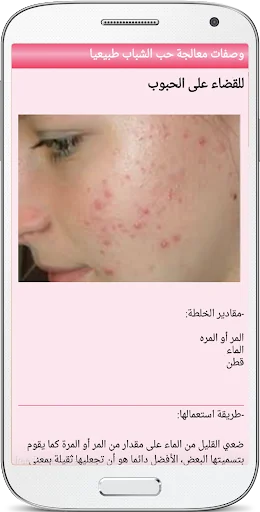 خلطات للوجه لازالة حب الشباب screenshot 3
