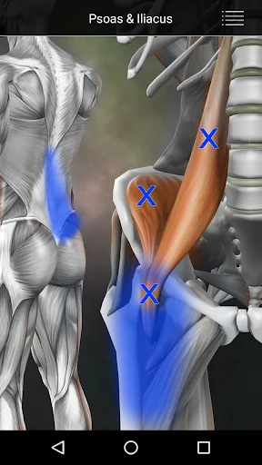 Muscle Trigger Point Anatomy screenshot 3