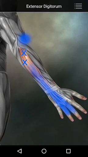 Muscle Trigger Point Anatomy screenshot 4