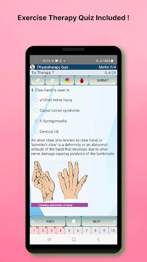 Physiotherapy Quiz screenshot 4