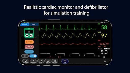 Simpl Patient Monitor