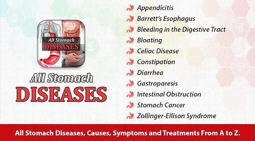 Stomach Diseases & Treatment