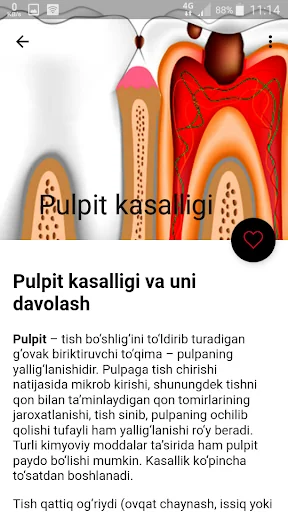 Tish kasalliklari va davosi