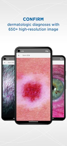 Dermatology DDx