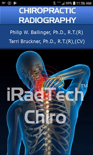 iRadTech Chiro