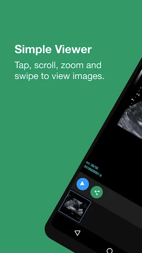 My Xrays – Quantum Patients screenshot 2