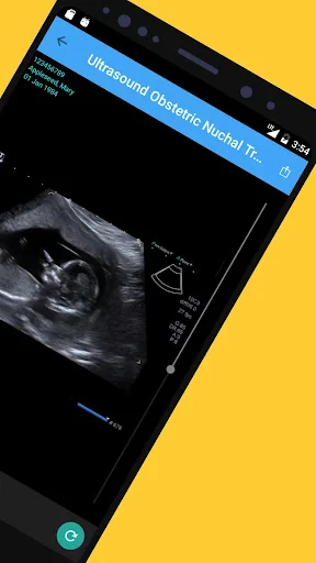My Xrays – Quantum Patients screenshot 3