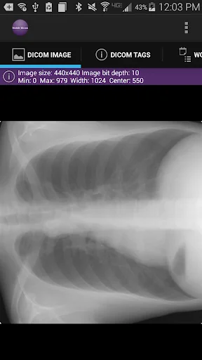 Mobile Dicom Viewer screenshot 2