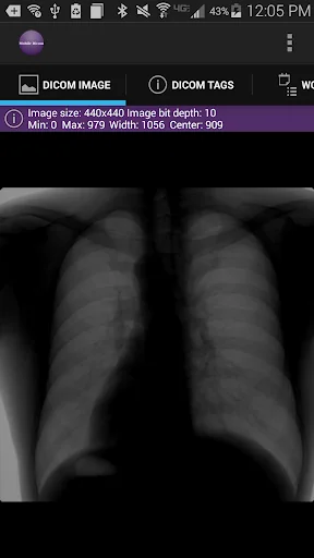 Mobile Dicom Viewer screenshot 4