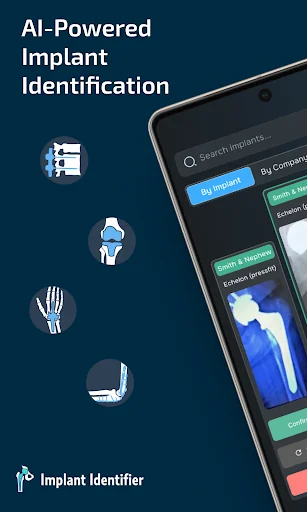 Implant Identifier