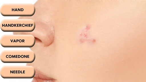 Pimple Popper screenshot 3