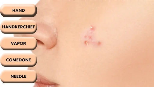 Pimple Popper screenshot 4