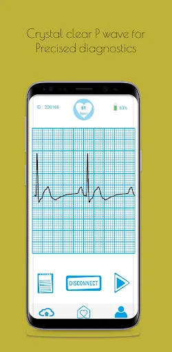 Biocalculus : Screen AFib
