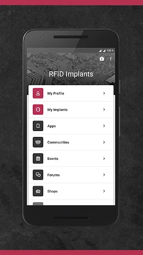 RFID Implants