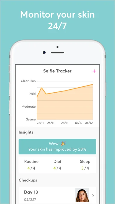 MDacne - Custom Acne Treatment screenshot 4