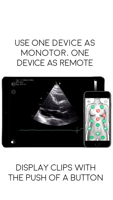 Awesome Ultrasound Simulator