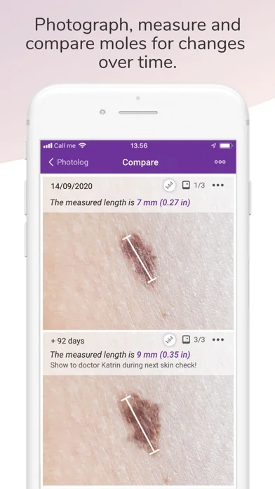 Miiskin Skin Tracker & eHealth