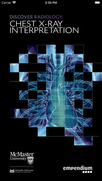 Chest X-ray Interpretation