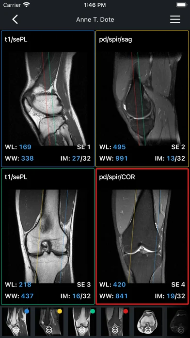 IDV - IMAIOS DICOM Viewer screenshot 3