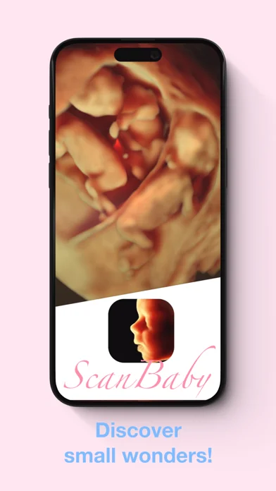 ScanBaby вивчити дитяче УЗД