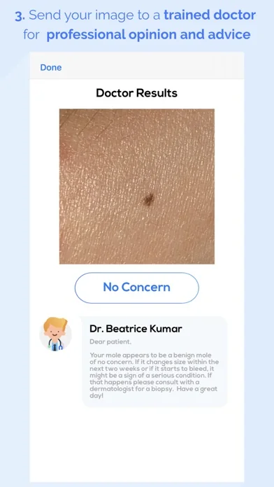 scanoma - mole check screenshot 3