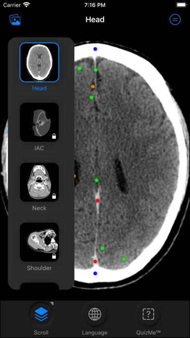 CT Anatomy screenshot 1