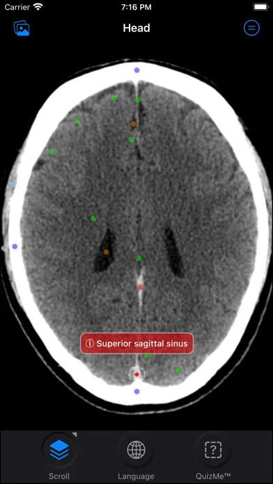 CT Anatomy screenshot 2